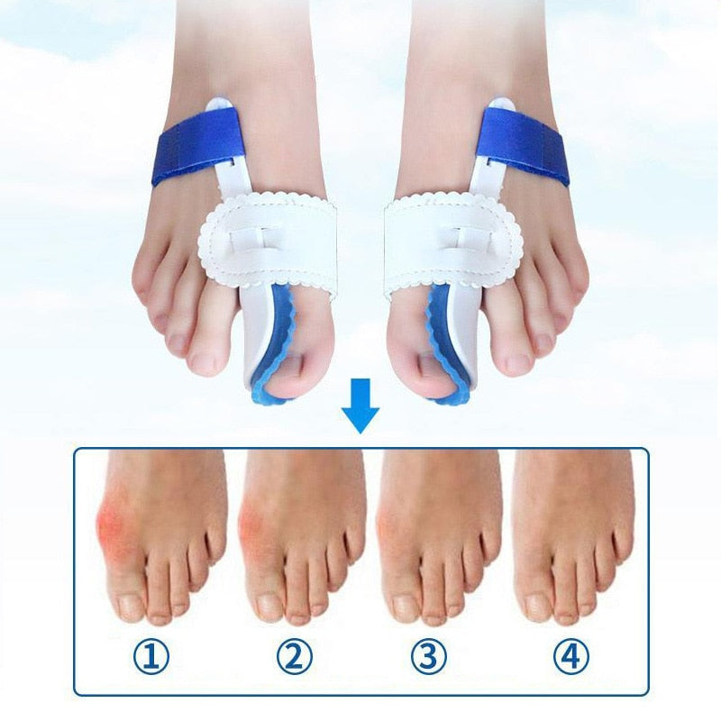 Correcteur hallux valgus ajustable en silicone HarmonyStep