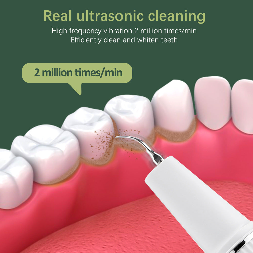 UltraSpark™ – Détartreur Dentaire Ultrason, l’Appareil Dentaire pour un Sourire Éclatant